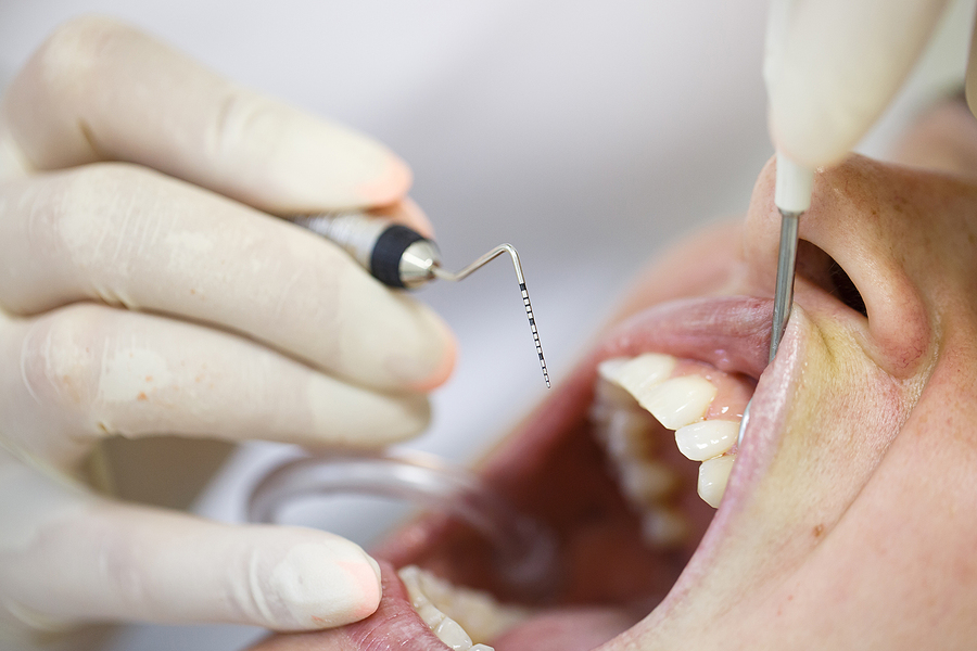 Understanding Periodontics: The Key to Healthy Gums and a Strong Smile
