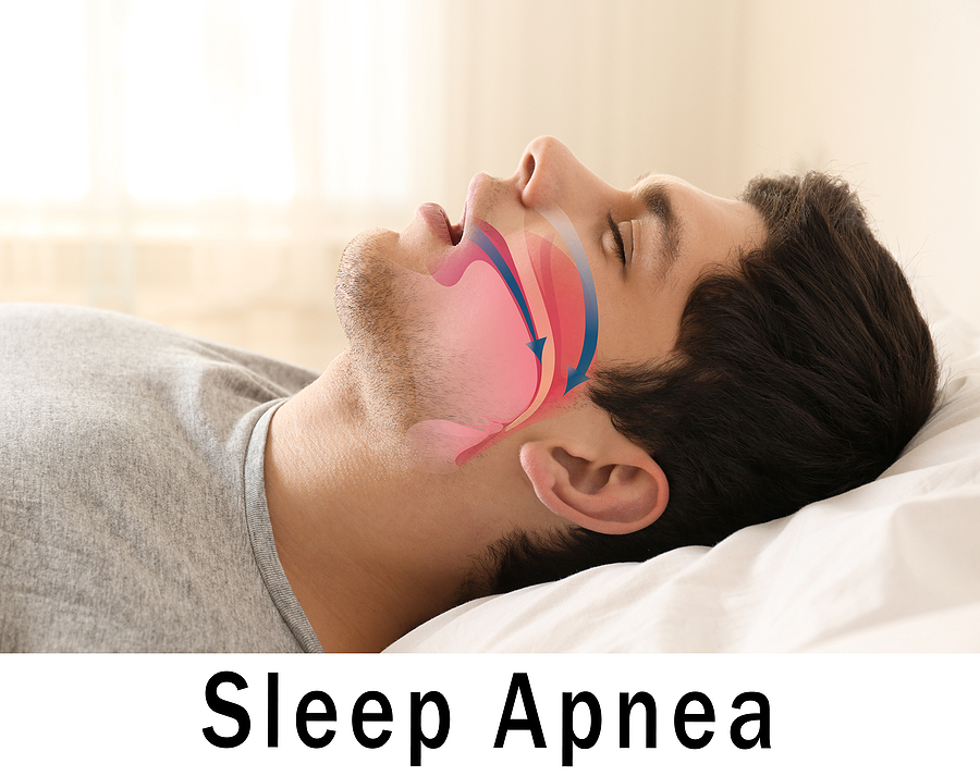 Comprehensive Solutions for Sleep Apnea in Citrus Heights, CA: Restoring Your Sleep and Health